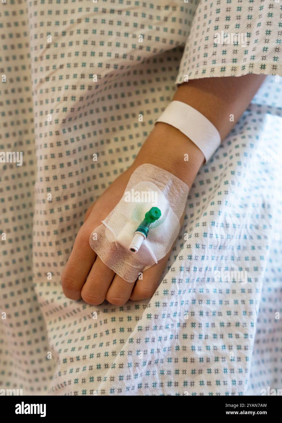 Bras féminin d'un jeune malade hospitalisé avec canule après chirurgie. Dispositif d'égouttement interne. Soins postopératoires. Banque D'Images