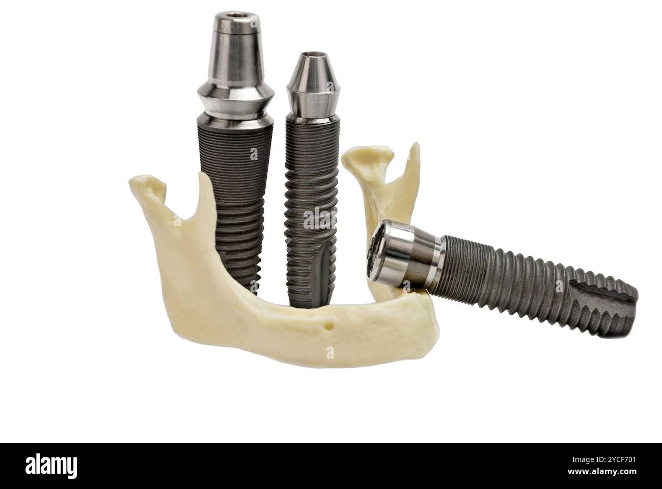 Modèles d'implants dentaires en titane et mâchoire humaine en plastique Banque D'Images