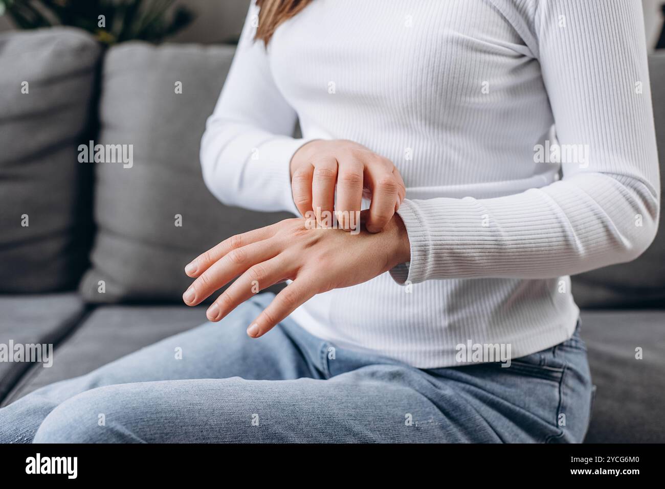 Jeune femme caucasienne avec une réaction allergique atopique, piqûres d'insectes sur son bras, main en grattant des démangeaisons, des démangeaisons rouges ou une éruption cutanée. Soins de santé Banque D'Images