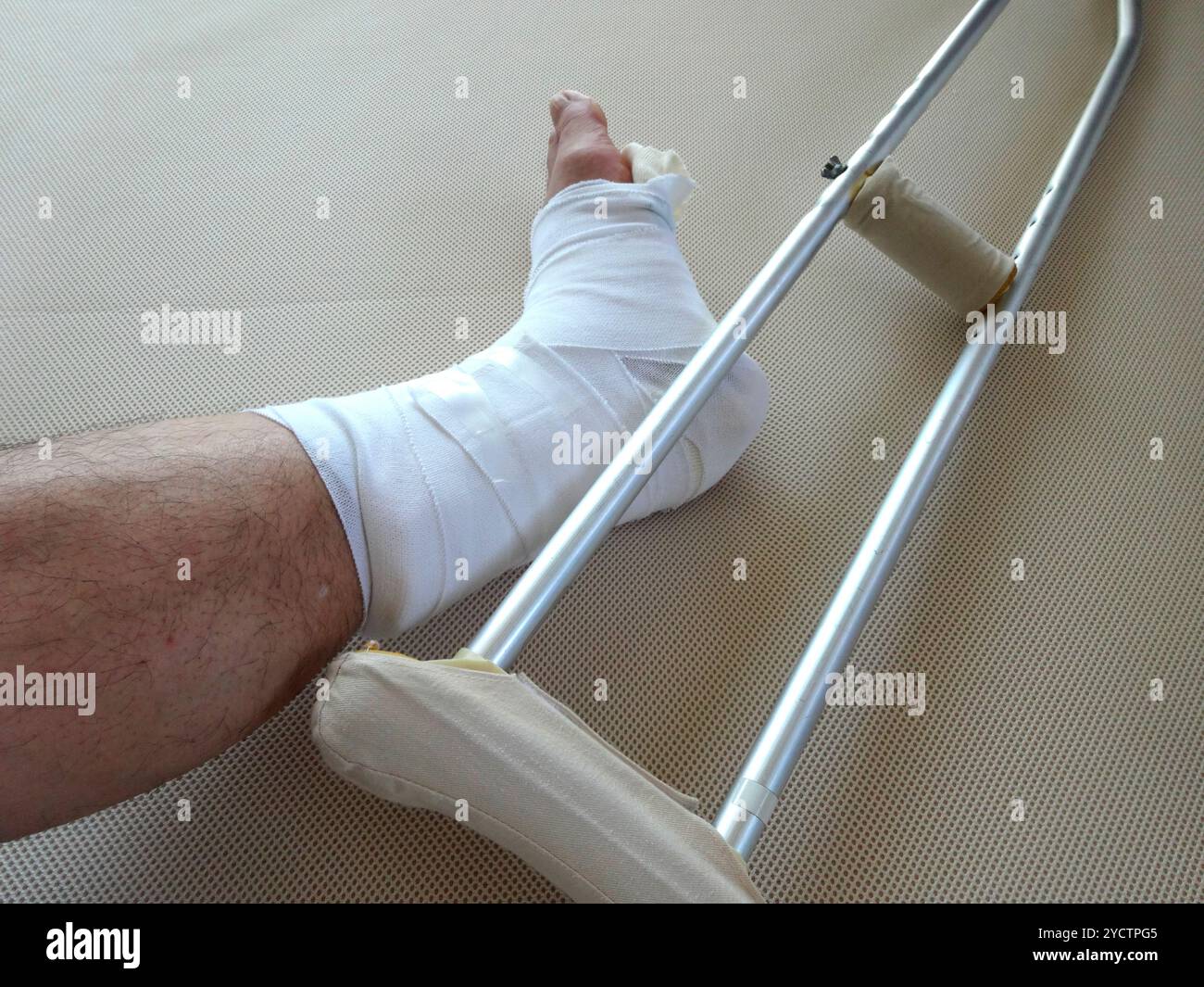 Plâtre pour fracture de la cheville Banque D'Images