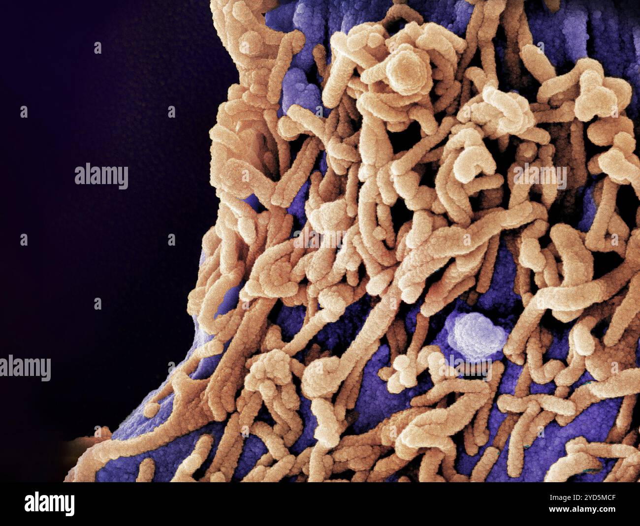 Micrographie électronique à balayage colorée des particules du virus de Marburg (orange) bourgeonnant et attachées à la surface d'une cellule VERO E6 infectée. Banque D'Images