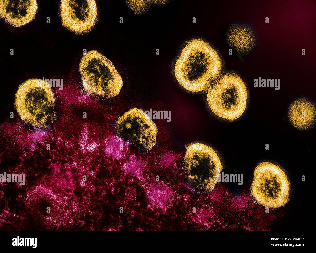 Micrographie électronique par transmission des particules du virus VIH-1 (colorées en jaune) répliquant à partir d'une cellule T H9 infectée par le VIH (rose). Banque D'Images