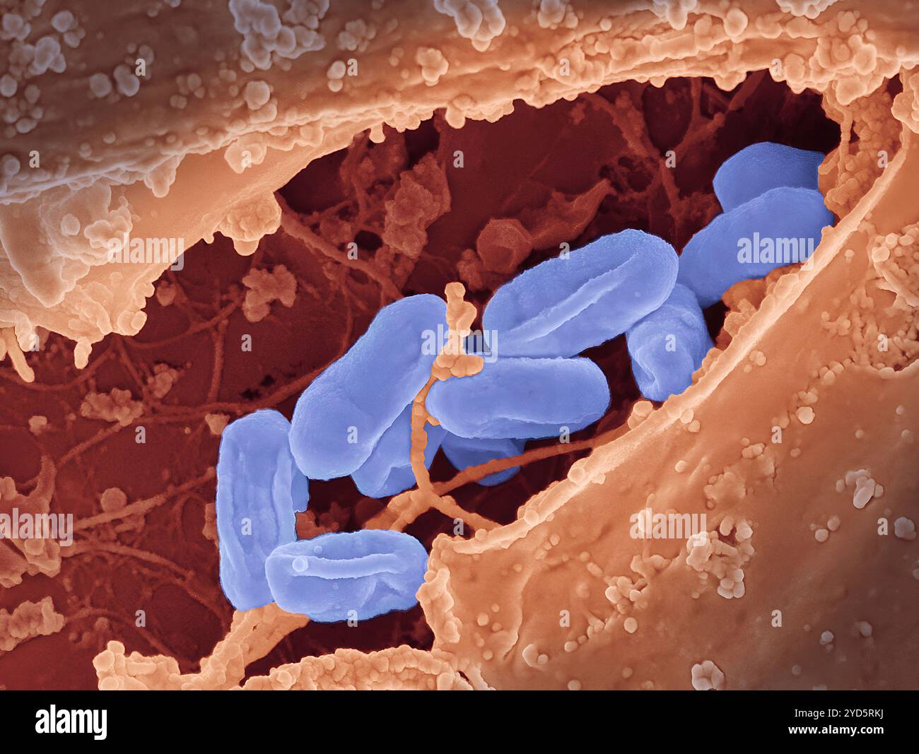 Micrographie électronique à balayage des bactéries Rickettsia typhi. Banque D'Images