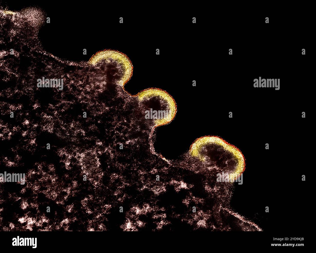 Micrographie électronique à transmission colorisée des particules virales VIH-1 jaunes et rouges bourgeonnant de la membrane plasmique d'une cellule T H9 infectée Bourgogne. Particules du virus VIH-1 bourgeonnant à partir d'un lymphocyte T H9 016867 233 Banque D'Images