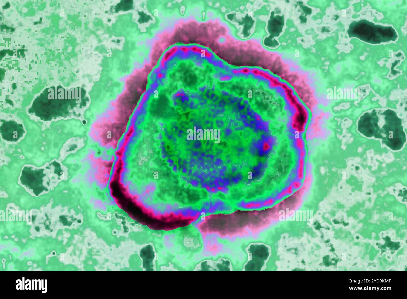 Virus de l'herpès HSV. HSV est la cause des boutons de froid, de l'herpès génital, de la varicelle, de la mononucléose infectieuse, de la roséole, parfois des bardeaux. Ils sont impliqués dans certains cancers dont le lymphome de Burkitt. Image de microscopie électronique. Virus de l'herpès 016836 017 Banque D'Images