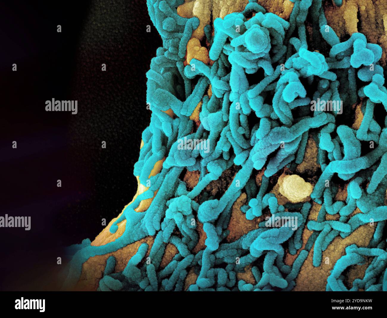 Micrographie électronique à balayage colorisé des particules de virus de Marburg sarcelle à la fois bourgeonnantes et attachées à la surface d'une cellule VERO E6 infectée or. Particules du virus de Marburg 016867_006 Banque D'Images