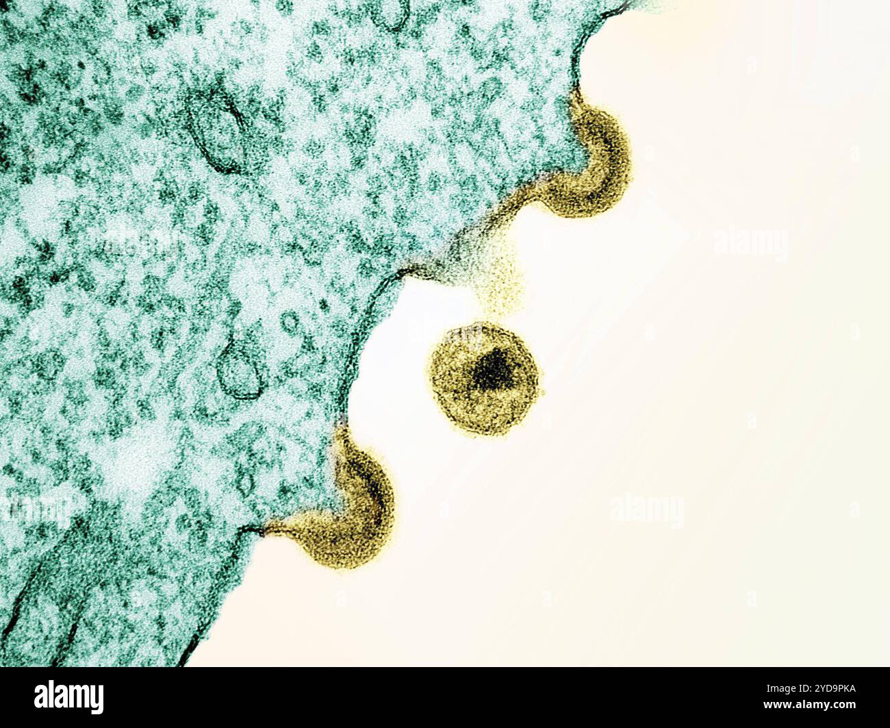 Micrographie électronique par transmission des particules virales VIH-1 jaunes à partir de cellules H9 infectées, produites en culture cellulaire. Les particules présentent deux étapes de réplication : les deux arcs sont des particules immatures bourgeonnant de la membrane plasmique de la cellule, et la particule sphérique centrale est une forme mature dans l'espace extracellulaire. Particules du virus VIH-1 016867 090 Banque D'Images