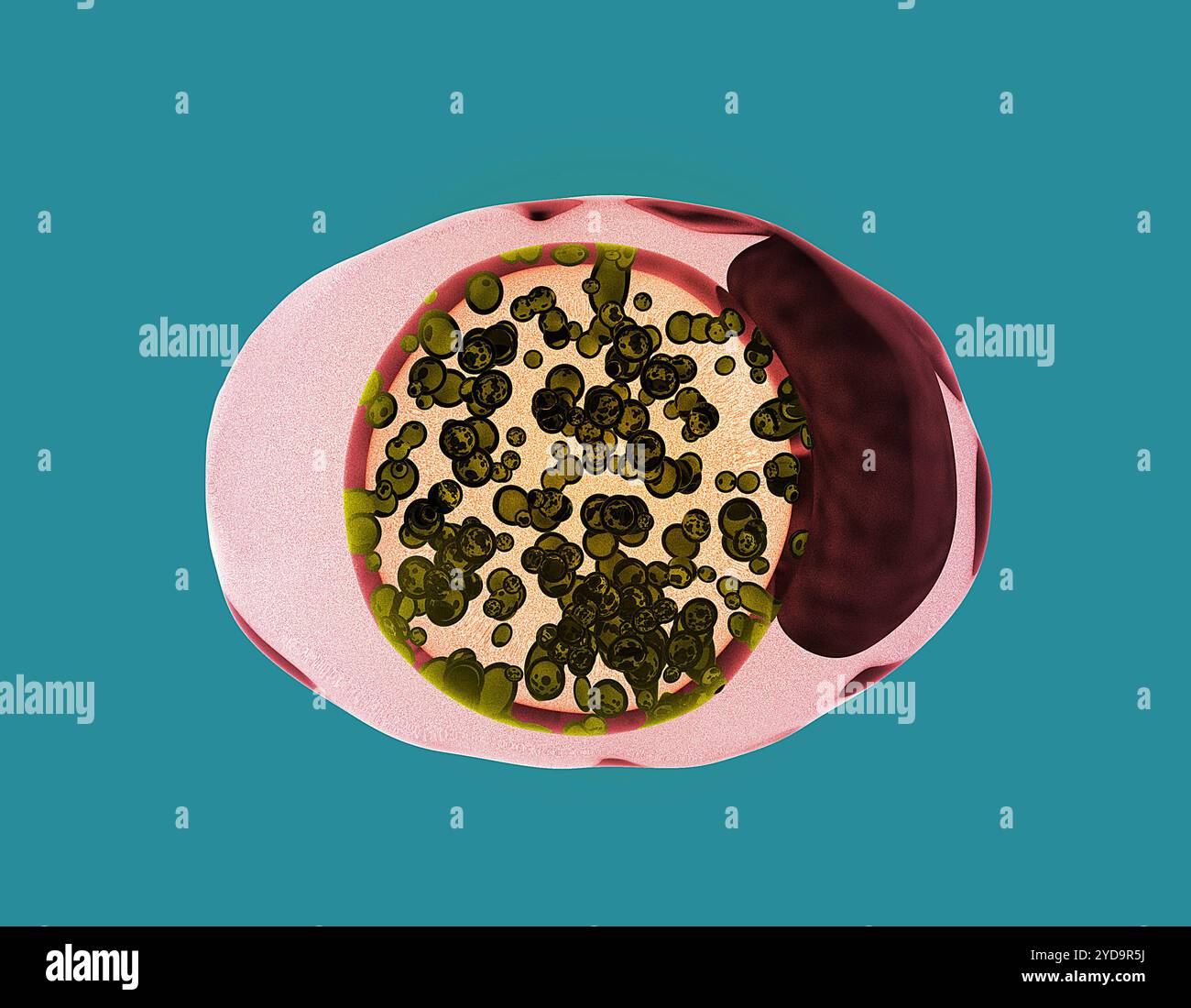 Illustration représentant une cellule infectée par la chlamydia. Les bactéries Chlamydia trachomatis représentées par de petites formes sphériques foncées colorées en jaune subissent le développement dans un corps de & quotinclusion entouré de membranes.&quot la forme rouge foncé sur la droite de la cellule indique le noyau. Chlamydia 016867 150 Banque D'Images