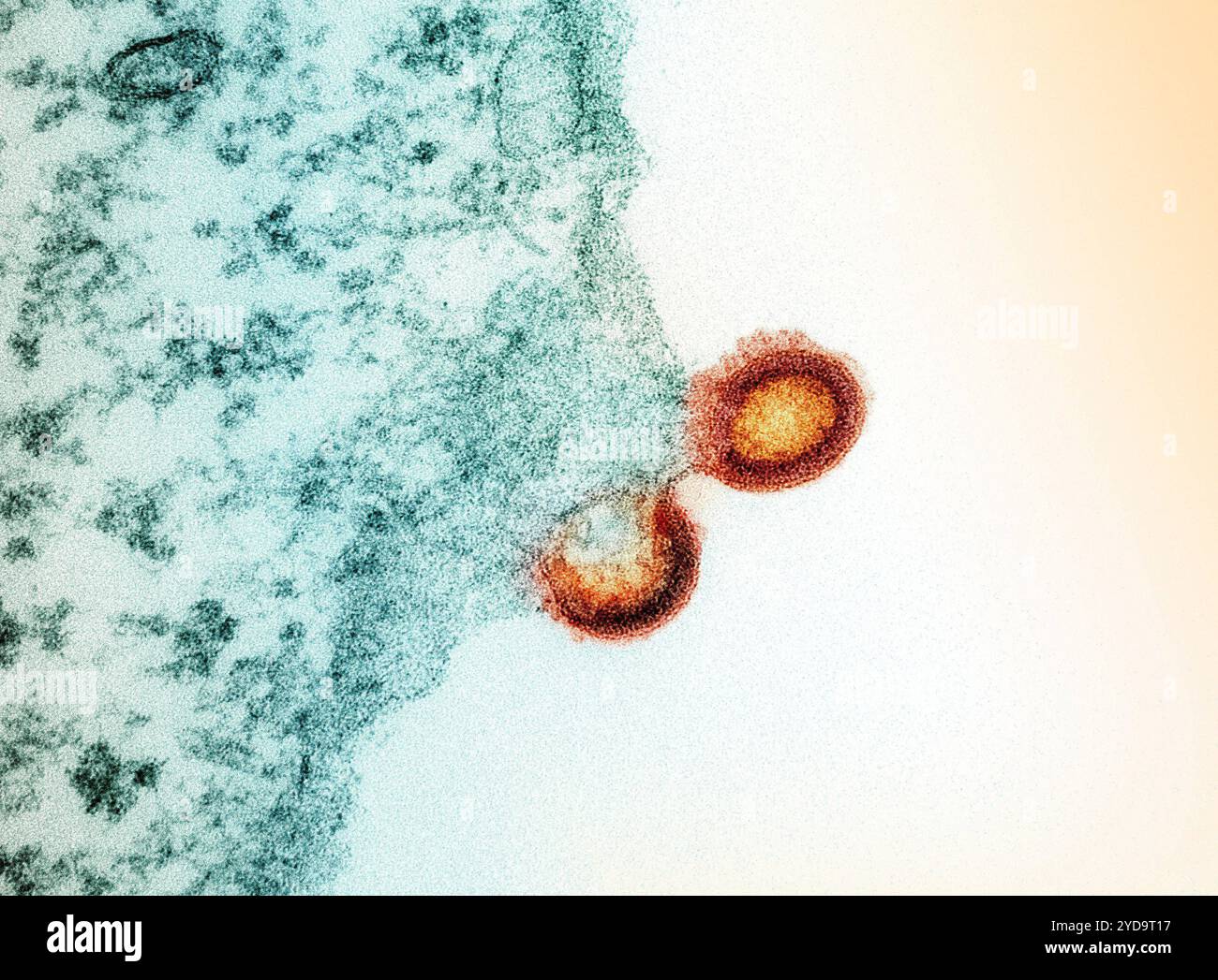 Micrographie électronique à transmission colorisée de deux particules de virus VIH-1 rouge/jaune bourgeonnant de la membrane plasmique d'un lymphocyte T sarcelle H9. 2024 : le traitement de longue durée d'action contre le VIH profite aux adultes qui ont des obstacles à la prise quotidienne de pilules et aux adolescents atteints d'une suppression du VIH. Particules du virus VIH 016867 274 Banque D'Images