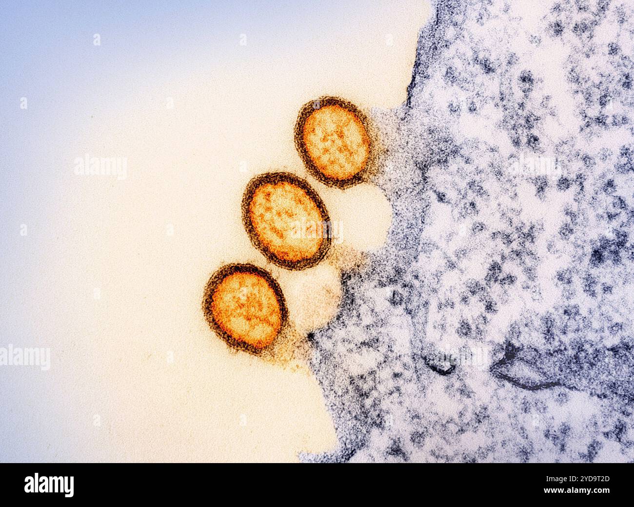 Micrographie électronique en transmission des particules de virus VIH-1 orange répliquant à partir de la membrane plasmique d'un lymphocyte T H9 pourpre. 2024 : le traitement de longue durée d'action contre le VIH démontre son efficacité chez les personnes éprouvant des difficultés prenant la médecine quotidienne prescrite. Particules du virus VIH 016867 270 Banque D'Images