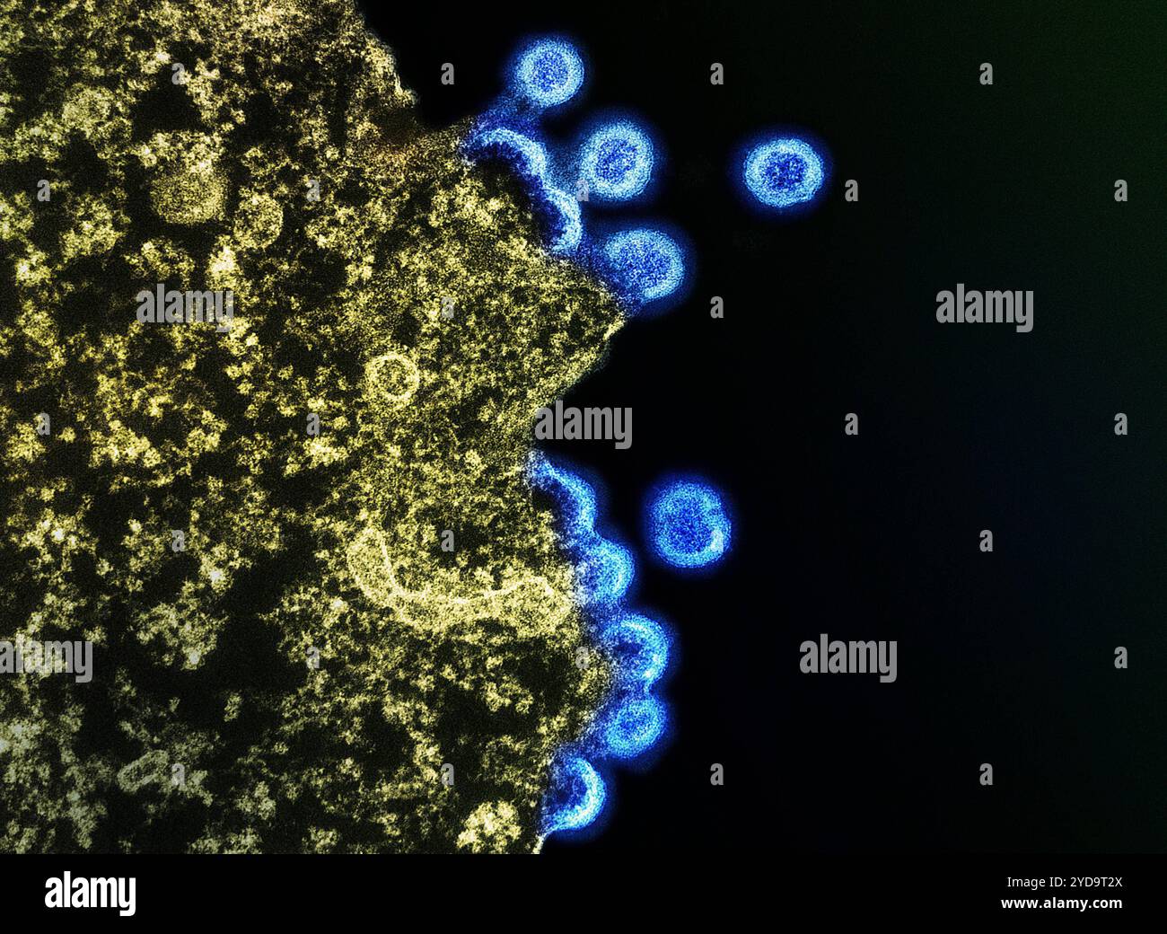 Micrographie électronique en transmission des particules bleues du virus VIH-1 répliquées à partir de la membrane plasmique d'un lymphocyte T H9 vert. 2024 : outils sous-estimer le risque d'événement cardiovasculaire chez les personnes vivant avec le VIH. Particules du virus VIH 016867 273 Banque D'Images