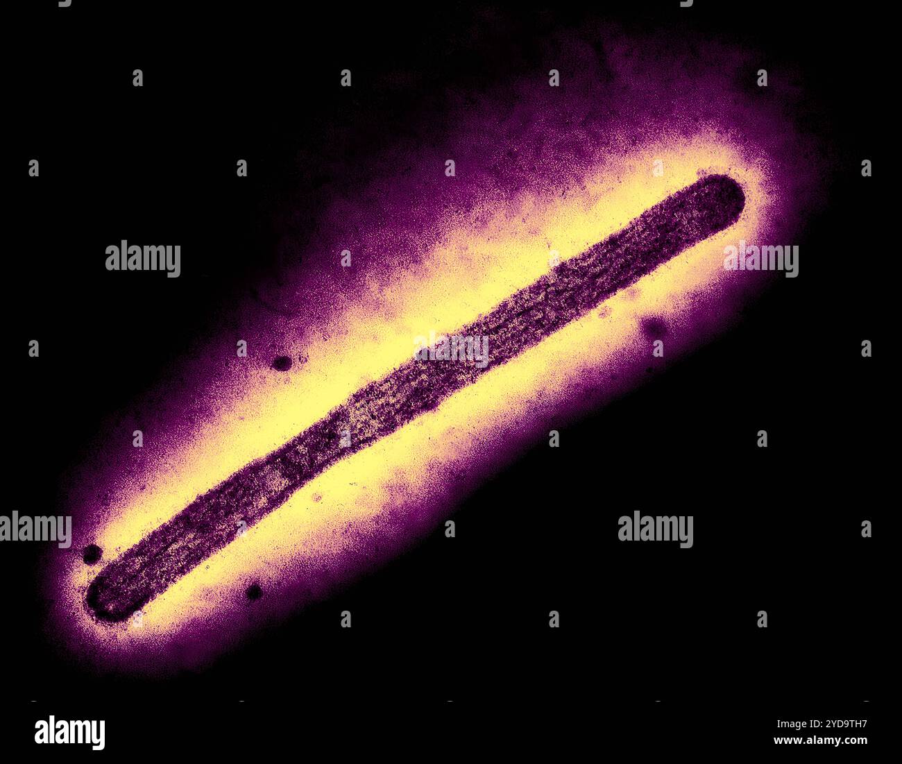 Image au microscope électronique à transmission d'un virion influenza A H5N1/grippe aviaire. Virus de l'influenza A H5N1/grippe aviaire 016867 318 Banque D'Images