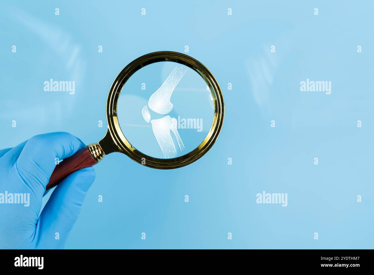 Bannière avec la main avec la loupe sur la rotule du squelette humain avec le point rouge. Douleur au genou. Ligaments entorses, déchirure du ménisque, tendinite, disloc Banque D'Images