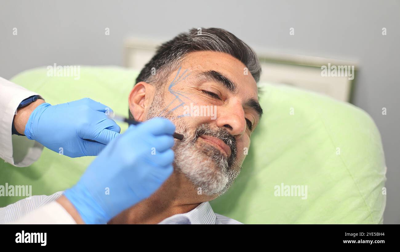 Médecin marquant le visage du patient masculin avec un stylo pour une procédure cosmétique dans une clinique de beauté, le patient souriant et détendu. Banque D'Images