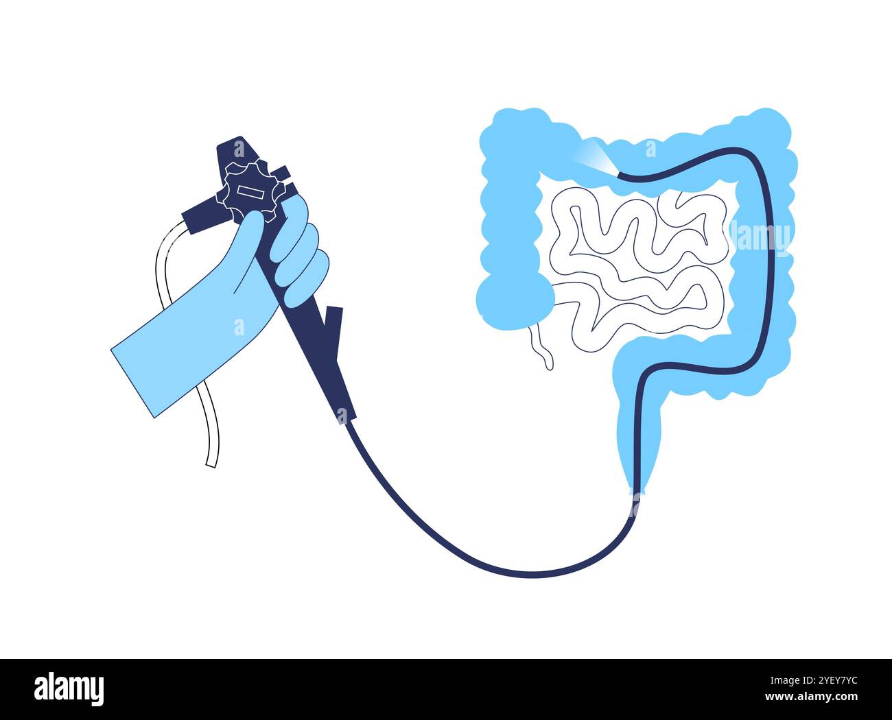 Illustration conceptuelle d'un procédé de coloscopie. Il s'agit d'un examen de l'intérieur de votre gros intestin, qui comprend le côlon, le rectum et l'anus. Il peut être utilisé pour explorer les causes possibles des douleurs abdominales, des saignements rectaux, des diarrhées chroniques et d'autres problèmes gastro-intestinaux. Il est également utilisé pour rechercher des signes possibles de cancer colorectal ou de polypes. Banque D'Images