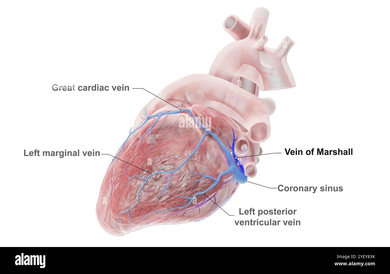 Illustration de veines coronaires avec la veine de Marshall (bleu foncé) mise en évidence. La grande veine cardiaque traverse le ventricule gauche (chambre inférieure) du cœur. La veine de Marshall, également connue sous le nom de veine oblique auriculaire gauche, est un vestige embryologique de la veine cave supérieure. On pense qu'elle est une source de déclencheurs de fibrillation auriculaire (FA), une fréquence cardiaque irrégulière et souvent anormalement rapide. Pour une version sans étiquette de cette image, voir F043/3536. Banque D'Images
