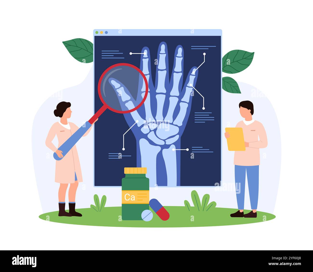 Les médecins étudient les articulations des mains à l'aide d'une loupe et d'une radiographie, discutent de la structure osseuse et des problèmes potentiels dans une illustration vectorielle de contexte médical. Illustration de Vecteur