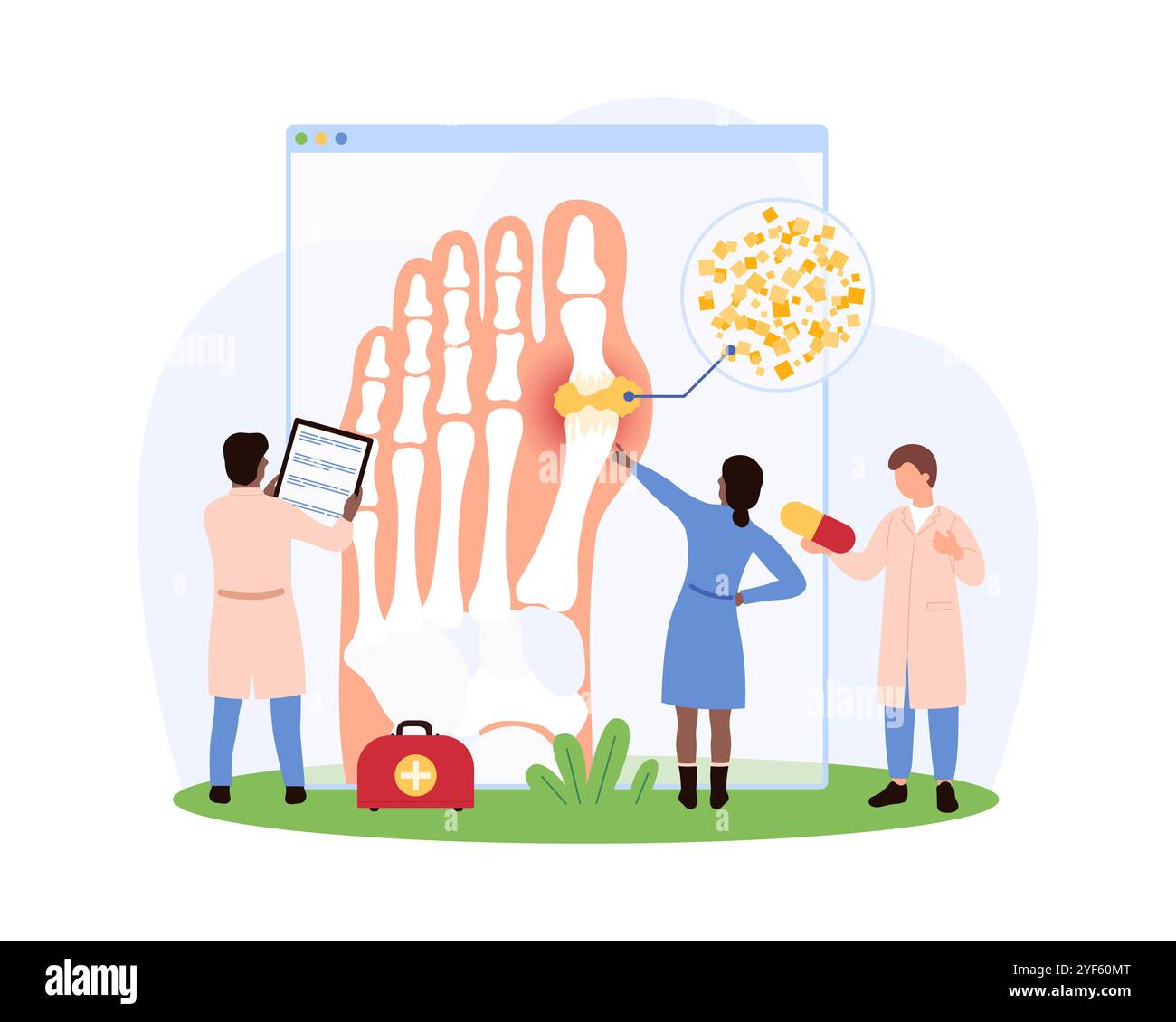 Les médecins examinant l'arthrite du pied d'un patient à l'aide d'une radiographie et d'outils médicaux, discutant de l'inflammation et du traitement dans un contexte clinique illustration vectorielle. Illustration de Vecteur