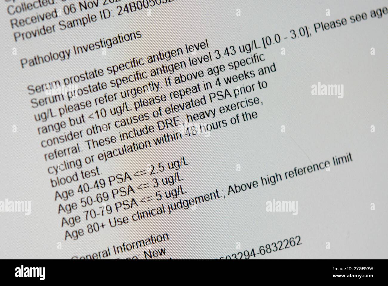 Résultat du test sanguin de l'antigène prostatique spécifique sur un écran PC. Numéros de référence de gamme spécifiques pour les âges. Tranches d'âge Banque D'Images