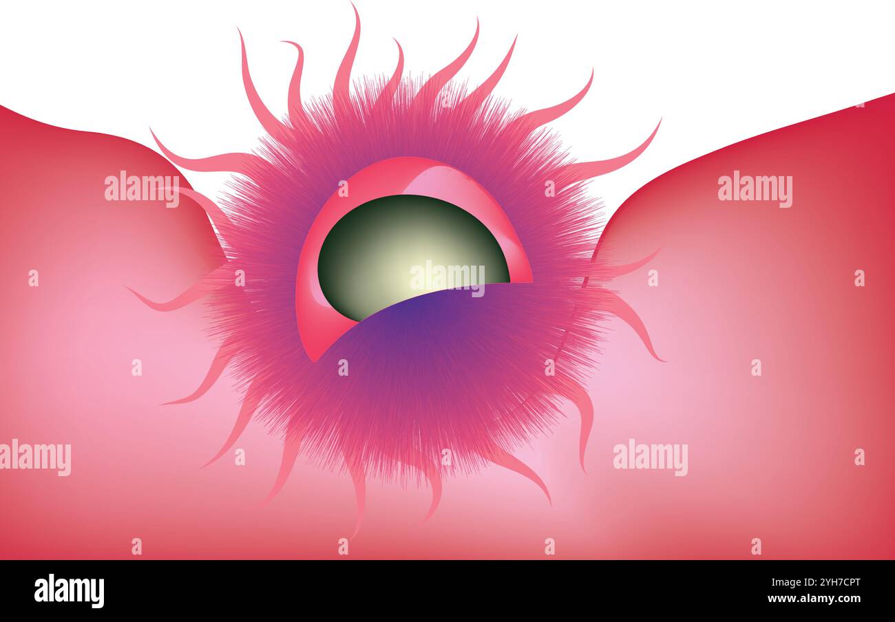 Cellule cancéreuse Illustration de Vecteur