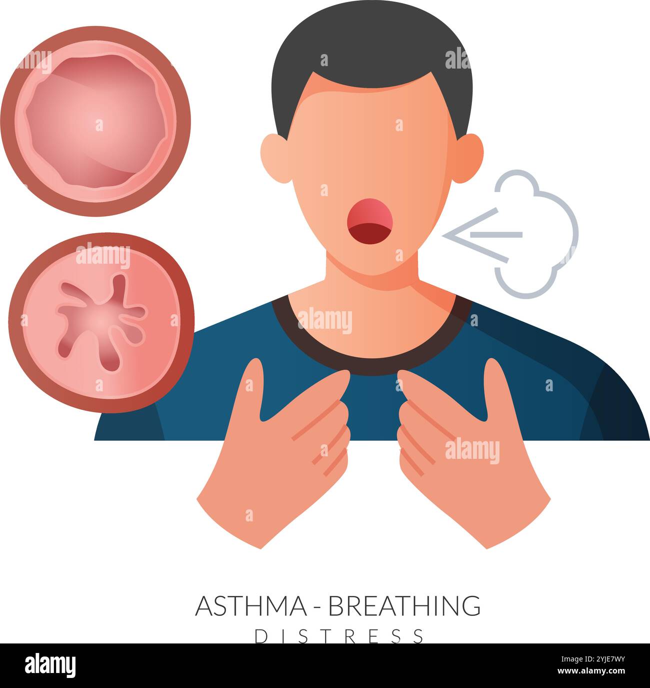 Asthme - essoufflement, respiration sifflante et toux - illustration en tant que fichier EPS 10 Illustration de Vecteur