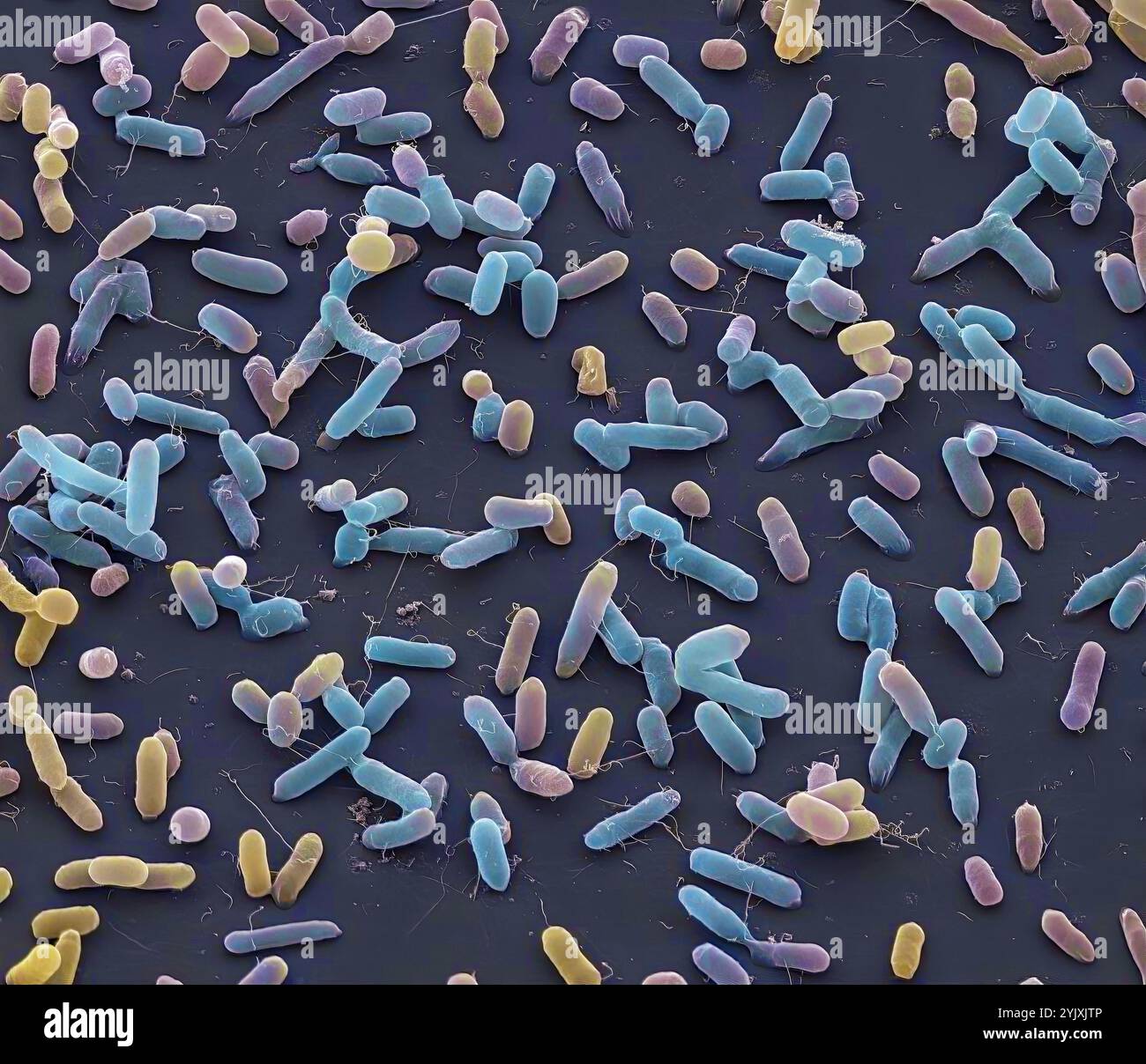 Bactéries Salmonella. Micrographie électronique à balayage couleur (MEB) des bactéries Salmonella. Des flagelles, des structures minces en forme de fils utilisées par les bactéries pour se déplacer, sont également visibles. La bactérie Salmonella peut causer une intoxication alimentaire lorsqu'elle est consommée dans des aliments contaminés comme les œufs crus. Dans les bonnes conditions, ils peuvent se multiplier rapidement. Les symptômes comprennent des douleurs abdominales, des nausées, des diarrhées et des vomissements. La typhoïde est également causée par une bactérie Salmonella typhi. Grossissement : x6000 lorsqu'il est imprimé à 10cm de large. Banque D'Images