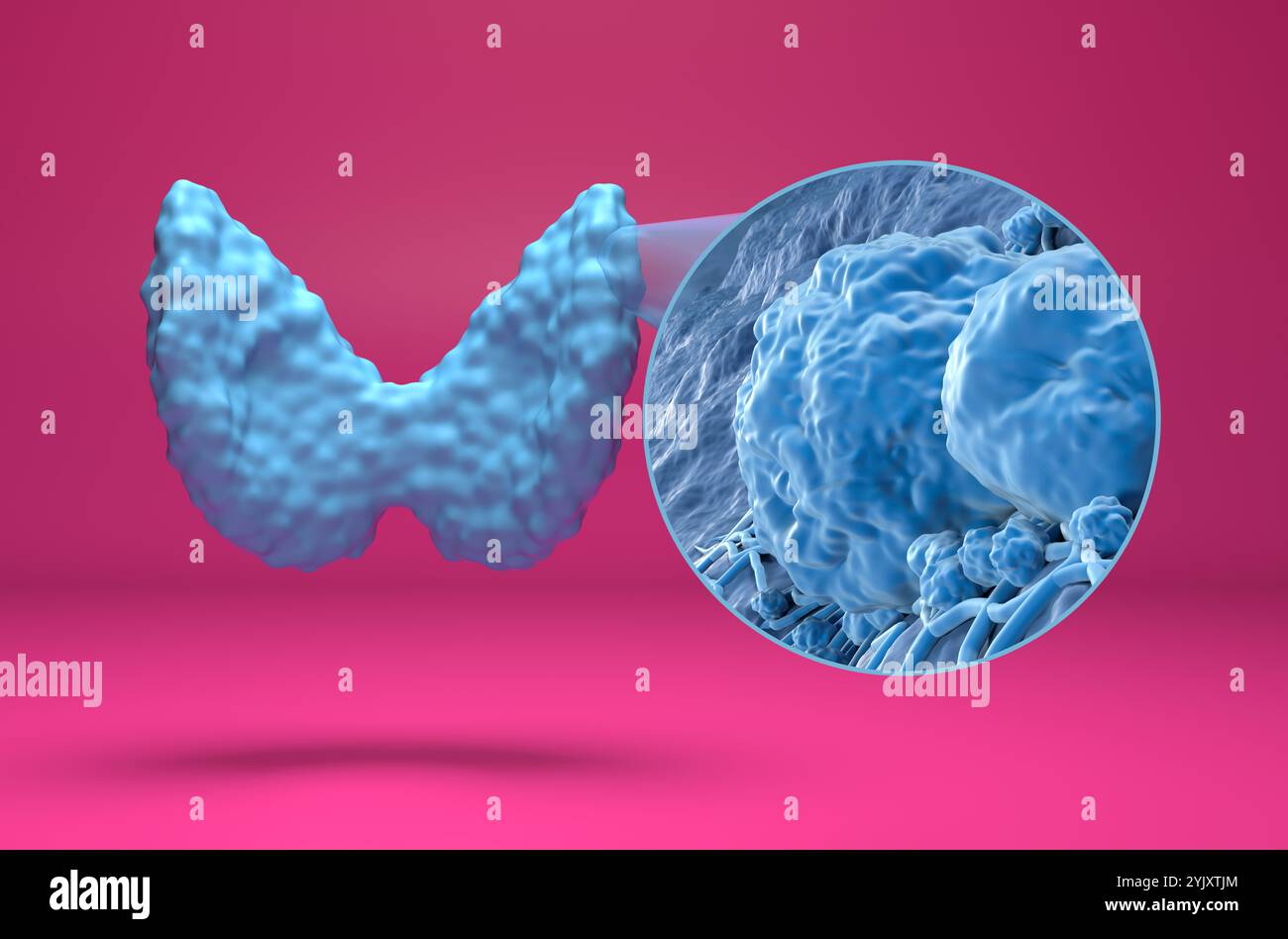 Cellules de cancer de la thyroïde - vue isométrique 3D illustration Banque D'Images