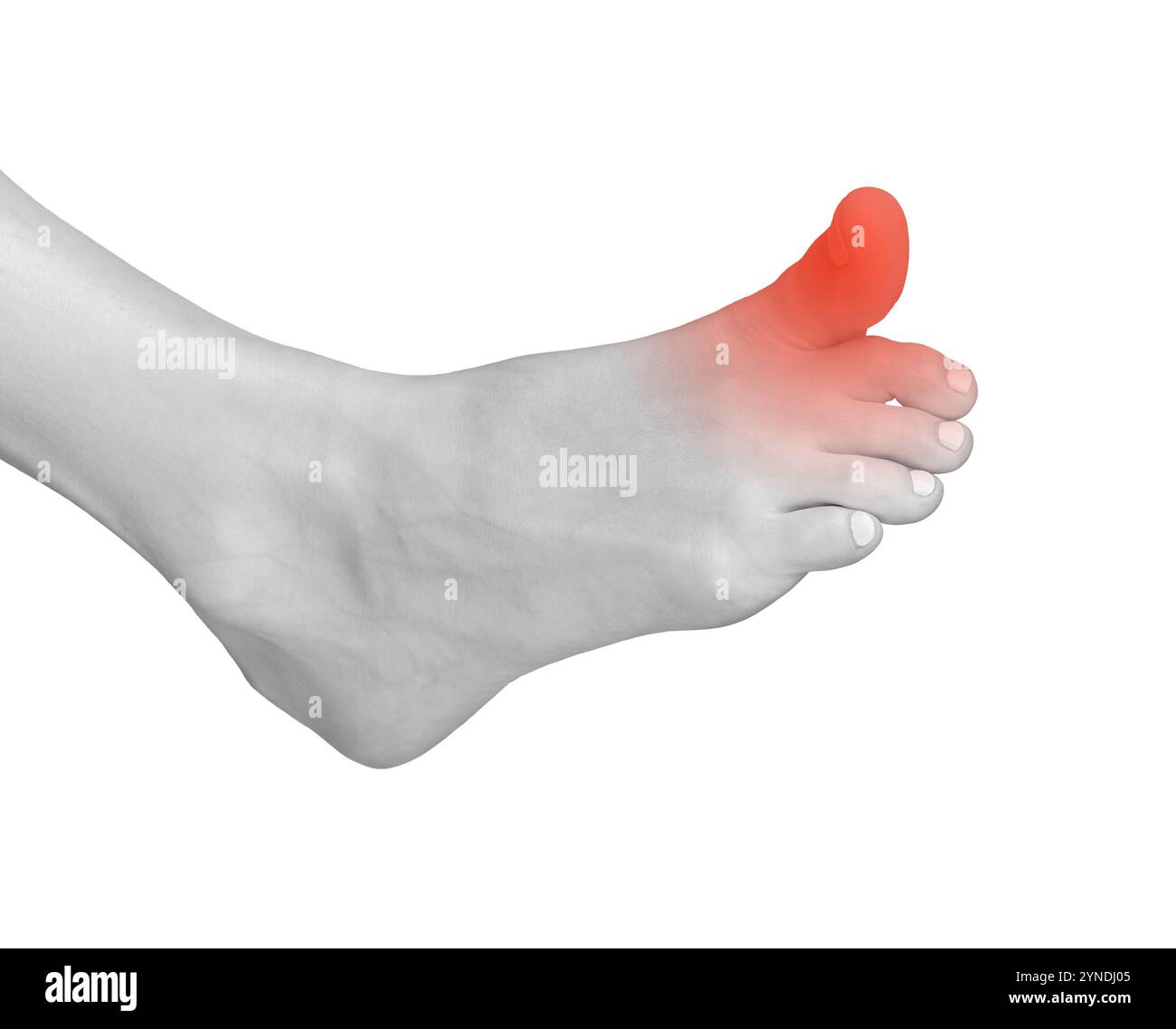 Douleur au gros orteil, contusion du pied due à une tension ou à une blessure. Articulations douloureuses et tendues avec neuropathie ou arthrite. Souffrance chronique, inflammation et trau musculaire Banque D'Images Douleur au gros orteil, contusion du pied due à une tension ou à une blessure. Articulations douloureuses et tendues avec neuropathie ou arthrite. Souffrance chronique, inflammation et trau musculaire Banque D'Images