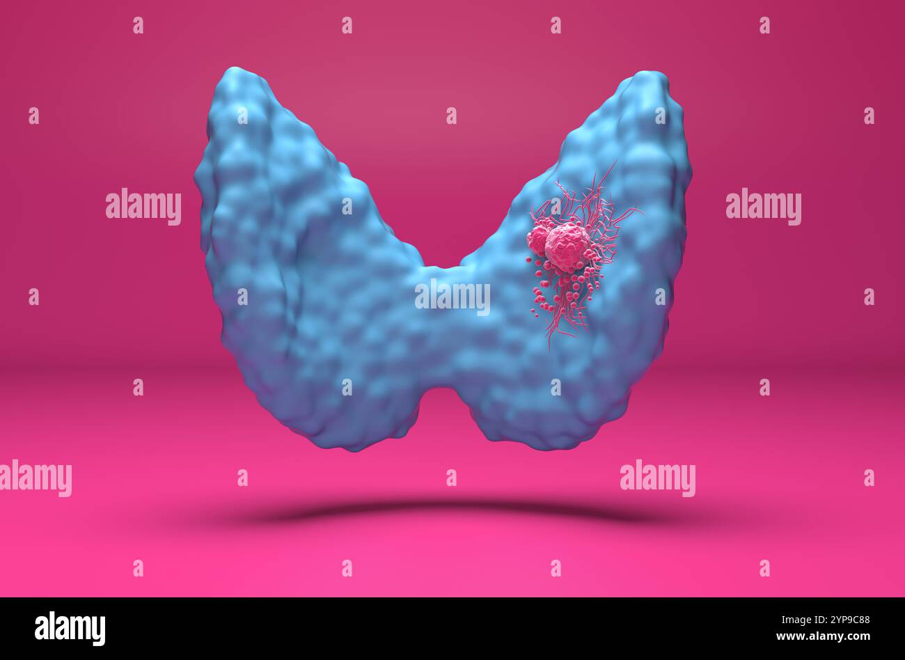 Cellules de cancer de la thyroïde - vue isométrique 3D illustration Banque D'Images