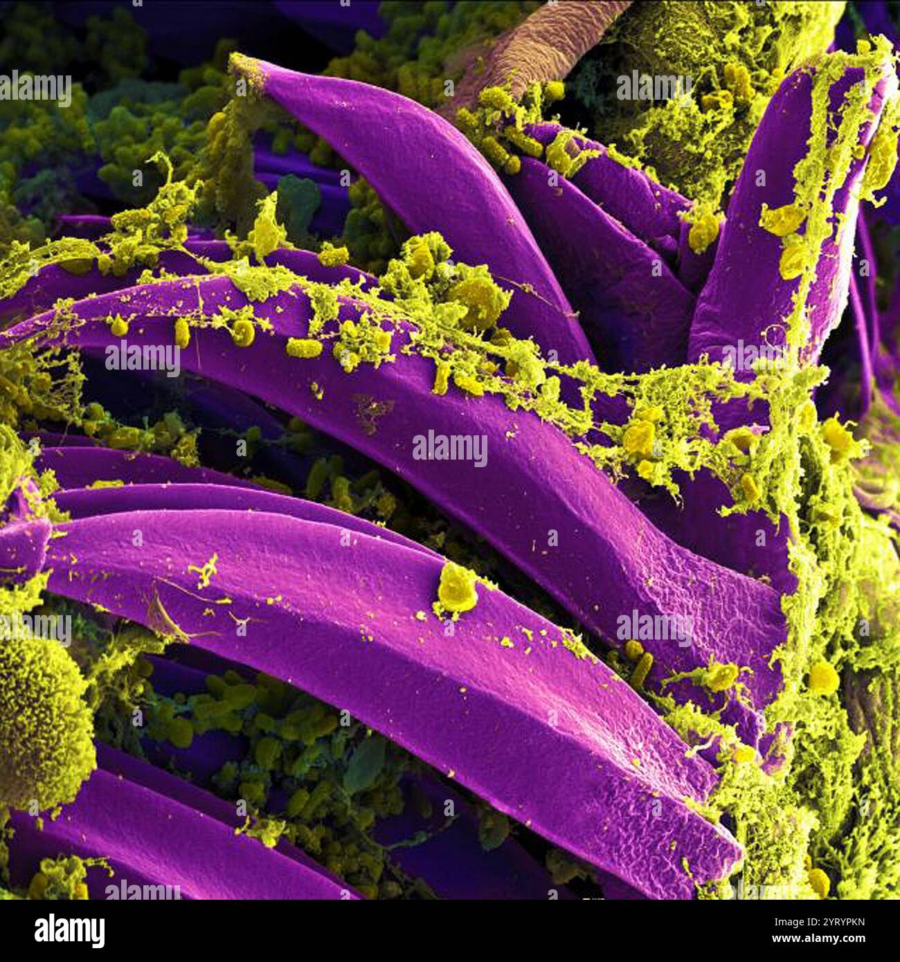 Image microscopique de jaune, ? Yersinia pestis?bactéries, dans le tube digestif d'a? Xenopsylla cheopis?puce. La bactérie est le pathogène qui cause la peste bubonique. Banque D'Images