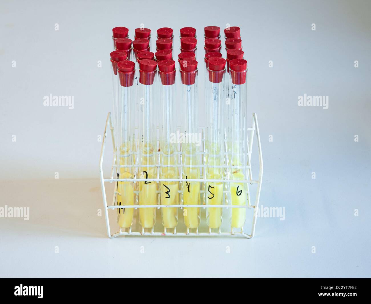Tubes à essai contenant des bâtonnets de pommes de terre dans une solution saline différente. En raison de l'osmose cela change la longueur du bâton. Expérience de biologie au lycée. Banque D'Images