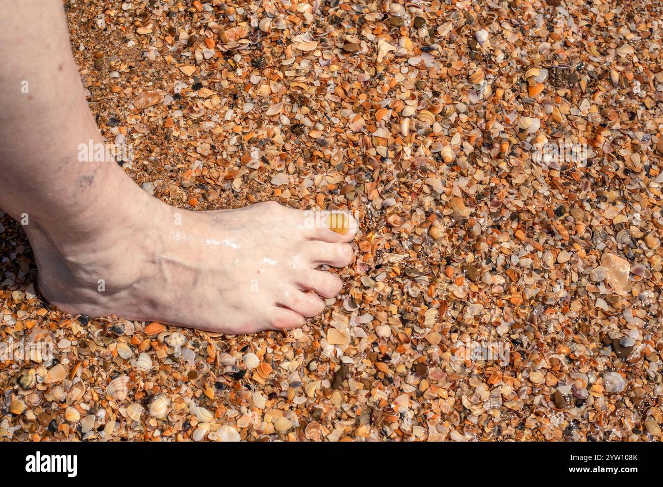 Pied de vieille femme avec gros ongle jaune sur le sable marin avec des coquilles. Mycose des ongles. Banque D'Images