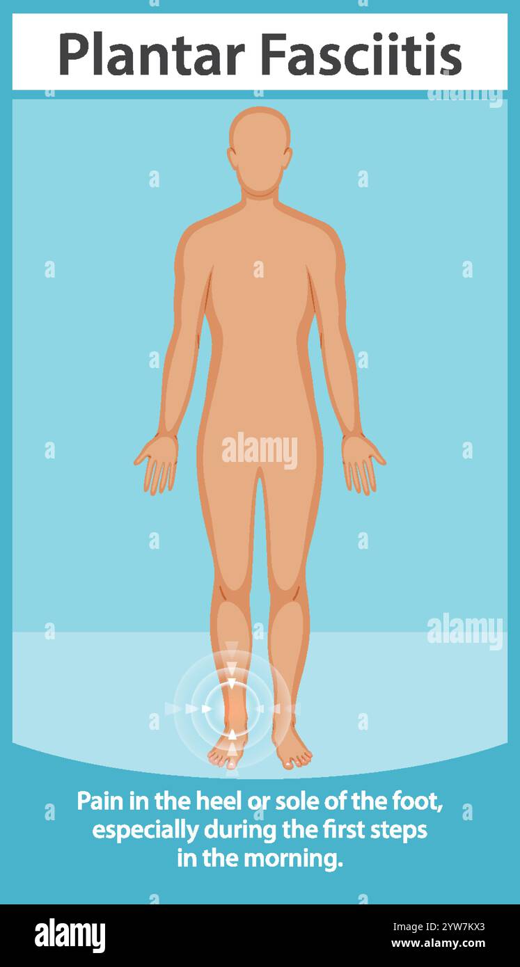 Illustration de la douleur au pied et de ses symptômes communs Illustration de Vecteur