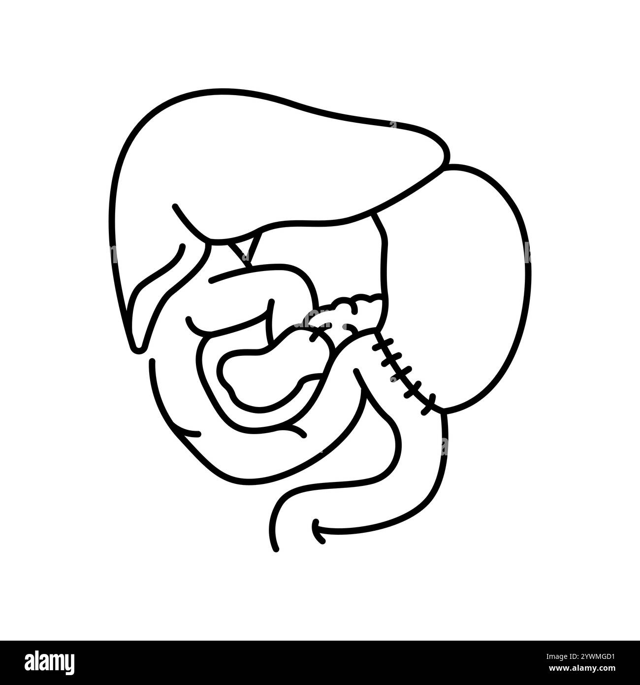 Icône noire de ligne d'anastomose bilio-digestive. Signez pour la page Web, l'application mobile, le bouton, le logo. Bouton isolé de vecteur. Contour modifiable. Illustration de Vecteur