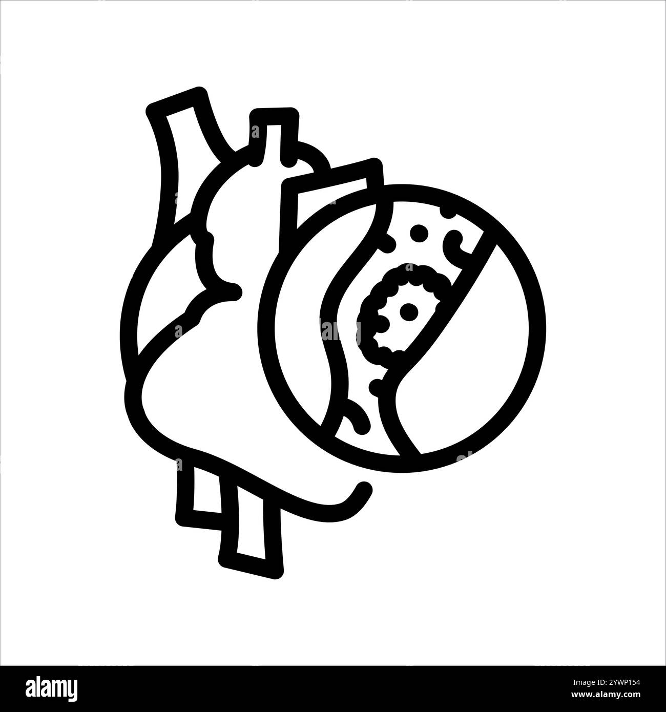 Thrombose de la ligne cardiaque icône noire. Signez pour la page Web, l'application mobile, le bouton, le logo. Bouton isolé de vecteur. Contour modifiable. Illustration de Vecteur