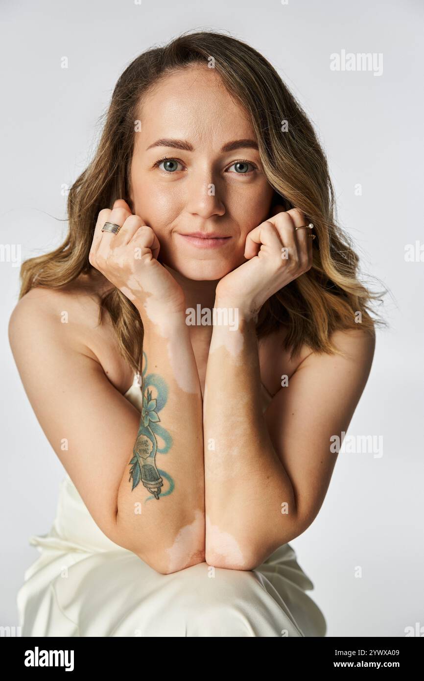 Femme au vitiligo pose gracieusement, montrant sa beauté et sa confiance dans un environnement calme. Banque D'Images