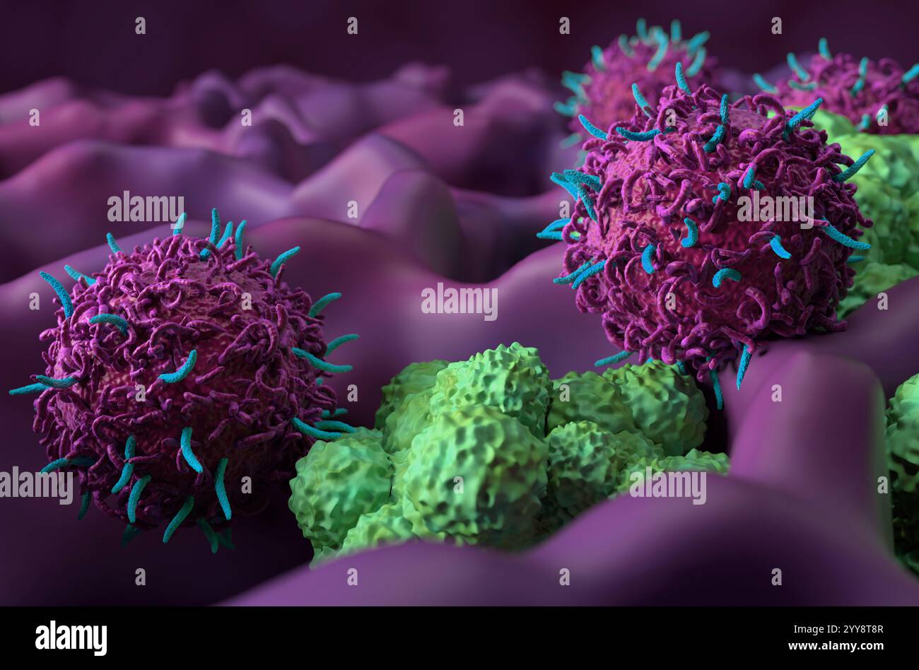 CAR T thérapie cellulaire dans le cancer du poumon (LC) - gros plan vue 3D. Banque D'Images
