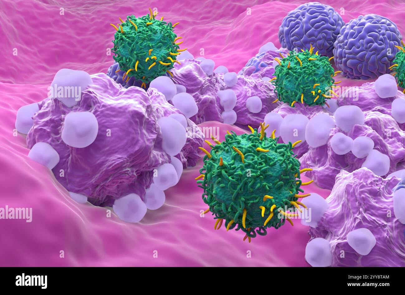 CAR T thérapie cellulaire dans le cancer de l'ovaire - gros plan vue 3D. Banque D'Images