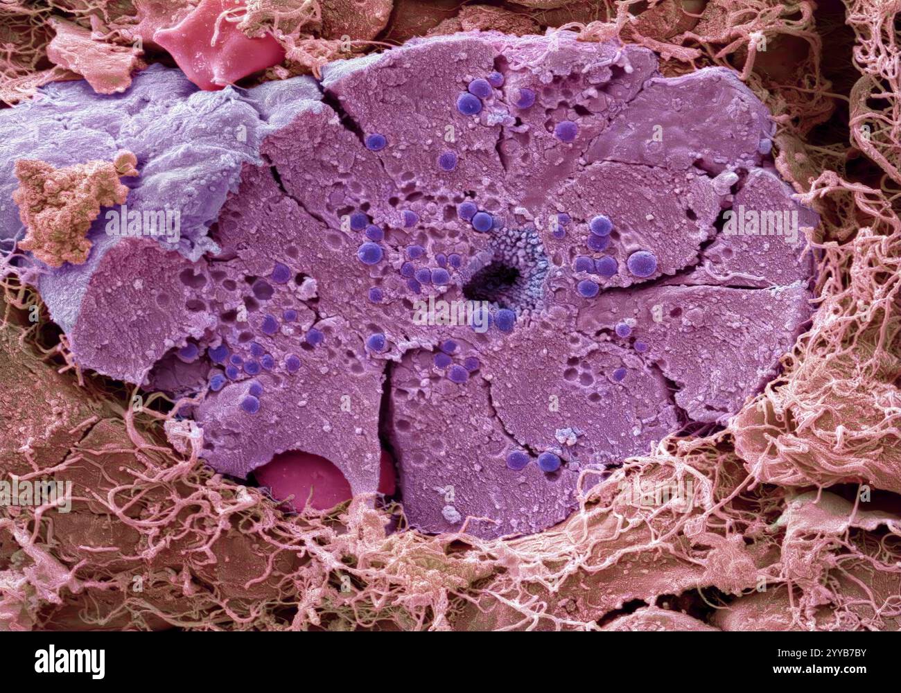 Cellules pancréatiques. Micrographie électronique à balayage coloré (MEB) des cellules pancréatiques acineuses (exocrines). Les cellules acineuses produisent et excrètent des enzymes digestives dans l'intestin grêle, via les canaux pancréatiques (au centre). Les enzymes sont excrétées dans des vésicules connues sous le nom de granules zymogènes. Les enzymes sont activées dans l'intestin grêle et aident à la dégradation des glucides, des graisses et des protéines. Les protéines sont produites, emballées et sécrétées par le réticulum endoplasmique de la cellule et l'appareil de golgi. Le tissu conjonctif entoure l'acinus. Grossissement : x3500 lorsqu'il est imprimé 10 centimètres de large Banque D'Images