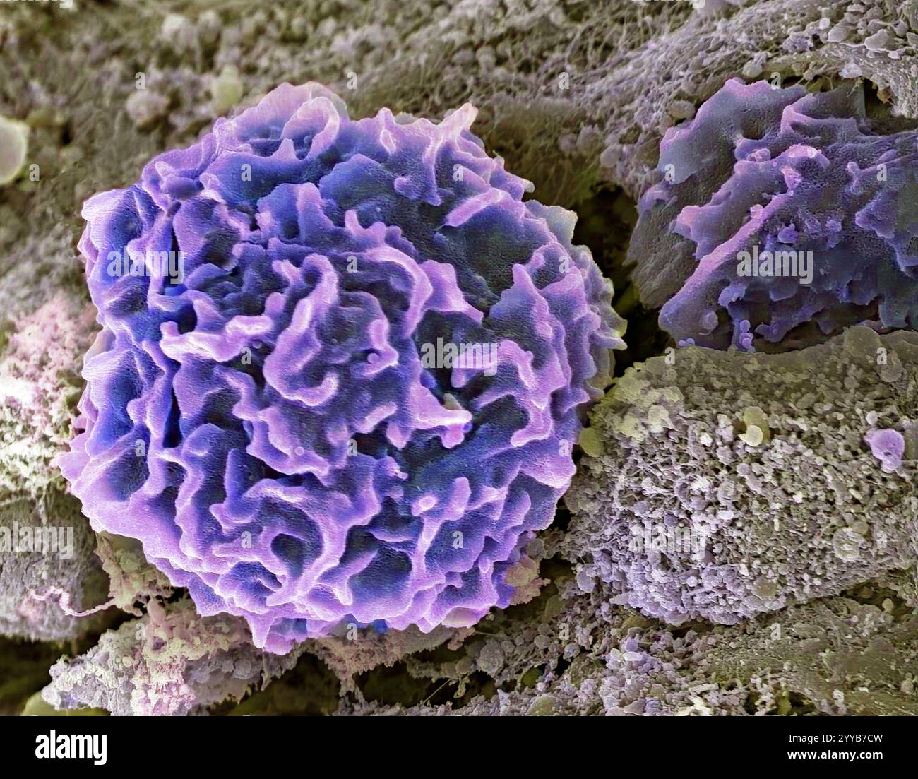 Macrophages. Micrographie électronique à balayage coloré (MEB) des globules blancs macrophages au site d'une plaie cutanée. Les macrophages sont des cellules du système immunitaire du corps. On les trouve dans les tissus plutôt que dans le sang circulant. Les macrophages reconnaissent les particules étrangères, y compris les bactéries, le pollen et la poussière, et le phagocytose (engulf) et les digèrent. Grossissement : x3000 lors de l'impression à 10 centimètres de large. Banque D'Images