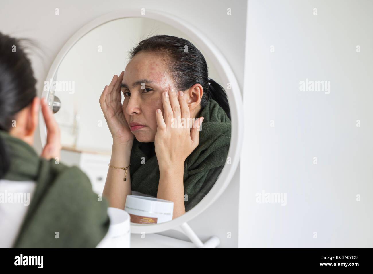 Anti rides vieillissement, inquiétude puberté jeune femme asiatique, stressé regardant dans le miroir, allergie présentant une réaction allergique de cosmétique sur le visage. Beauté, h Banque D'Images