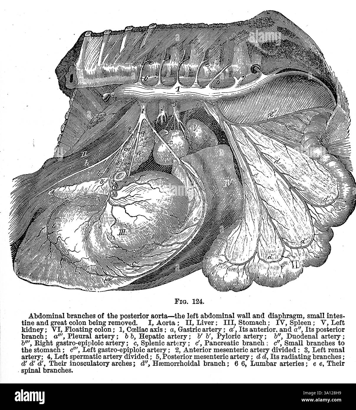 Branches abdominales de l'aorte postérieure — le Wau abdominal gauche et le diaphragme, l'intestin grêle et le gros côlon étant enlevés. I, aorte ; II, foie ; III, estomac ; IV, rate ; V, rein gauche ; VI, côlon flottant ; 1, axe cœliaque : a, artère gastrique ; a'. Sa branche antérieure, et a', sa branche postérieure ; a''. Artère pleurale ; b h, artère hépatique ; &' 6', artère pylorique ; h', artère duodénale ; h''. Artère gastro-épiploïque droite ; c, artère splénique ; cf, branche pancréatique : c/'. Petites branches à l'estomac ; c''. Artère gastro-épiploïque gauche ; 2, artère mésentérique antérieure divisée : 3, rénale gauche Banque D'Images