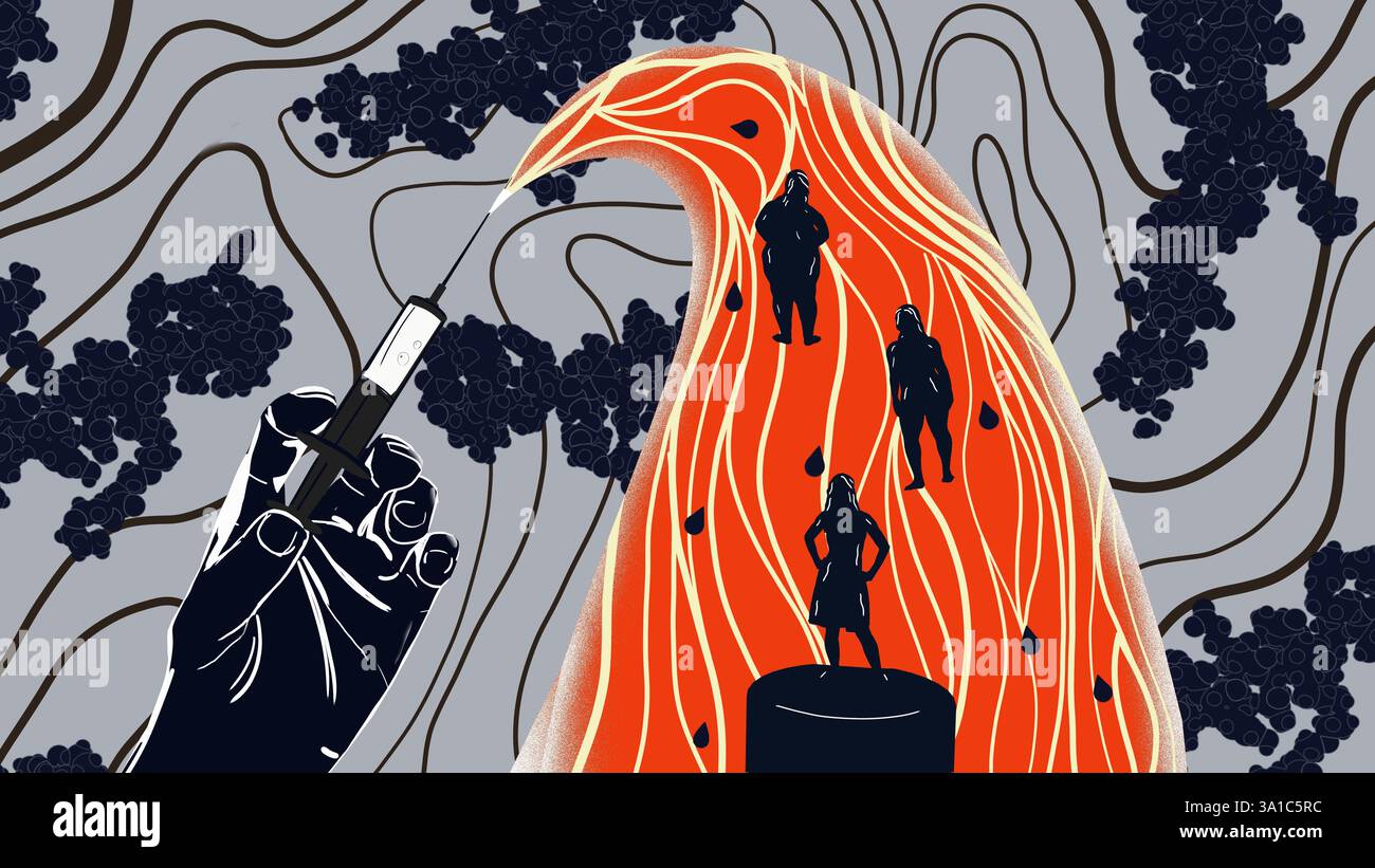 Semaglutide médicament amaigrissant, illustration conceptuelle. Commercialisé sous le nom d'Ozempic, le semaglutide est un analogue du peptide-1 de type glucagon (GLP-1) qui est utilisé pour traiter le diabète et pour la gestion du poids. Il augmente la production d'insuline, l'hormone qui abaisse le taux de sucre dans le sang, tout en supprimant la sécrétion de glucagon, l'hormone qui augmente le taux de sucre dans le sang. Il réduit également la faim et ralentit la vidange gastrique. Banque D'Images