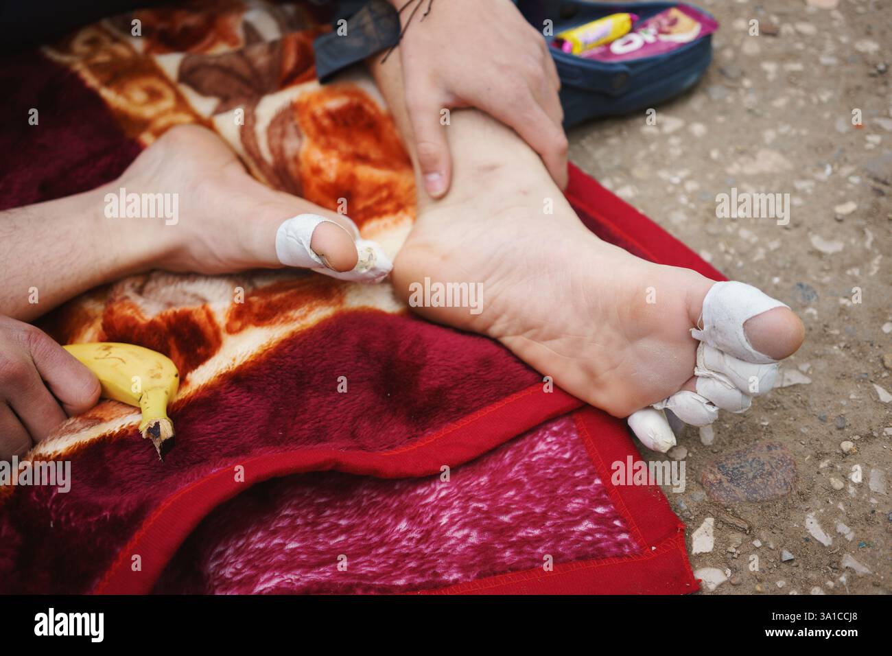 Bandages sur les orteils, vue rapprochée, cloques de longues promenades. Banque D'Images Bandages sur les orteils, vue rapprochée, cloques de longues promenades. Banque D'Images