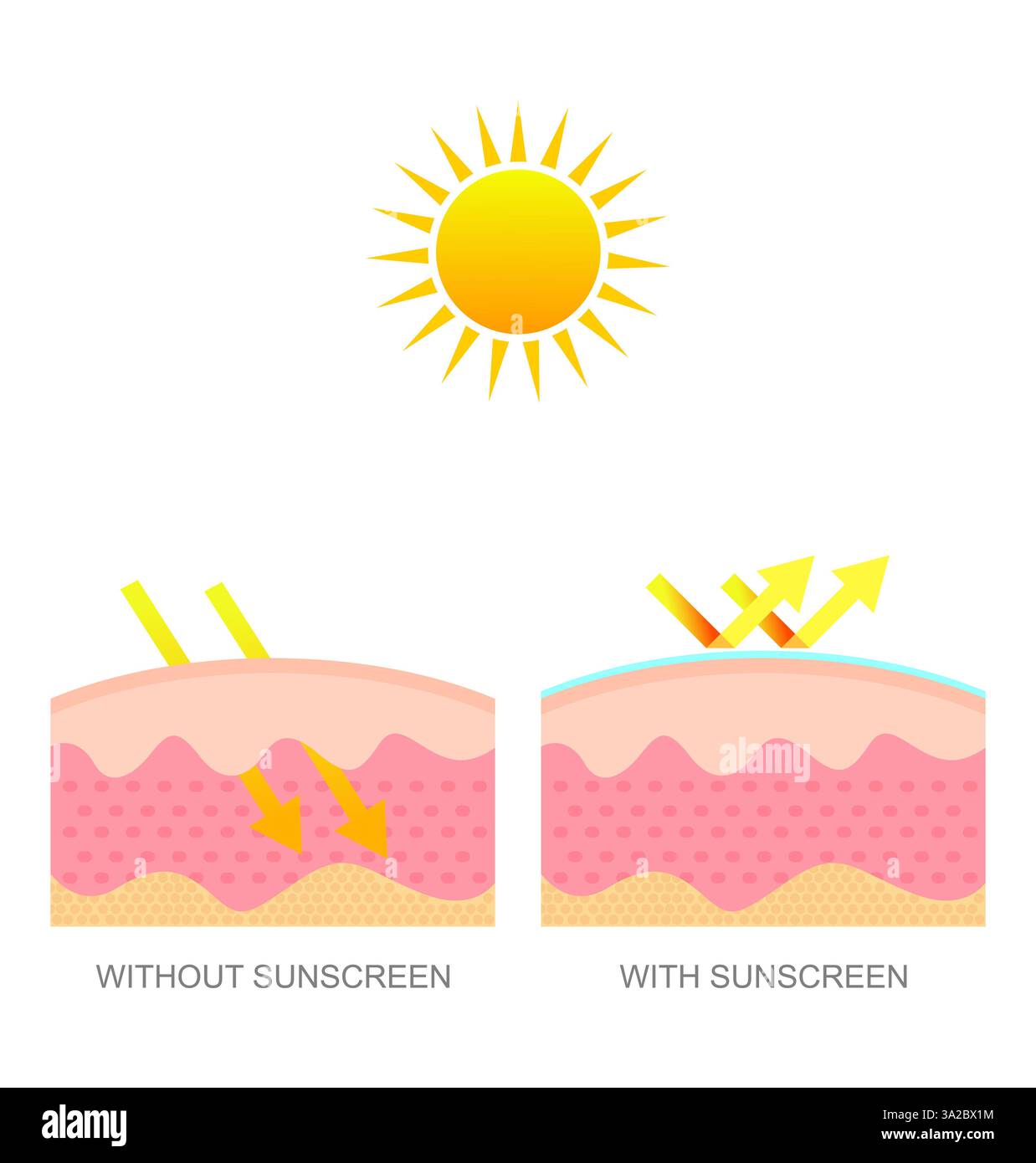 Comparaison de la peau sous protection solaire avec la peau normale. Protection de la peau contre le rayonnement ultraviolet Banque D'Images