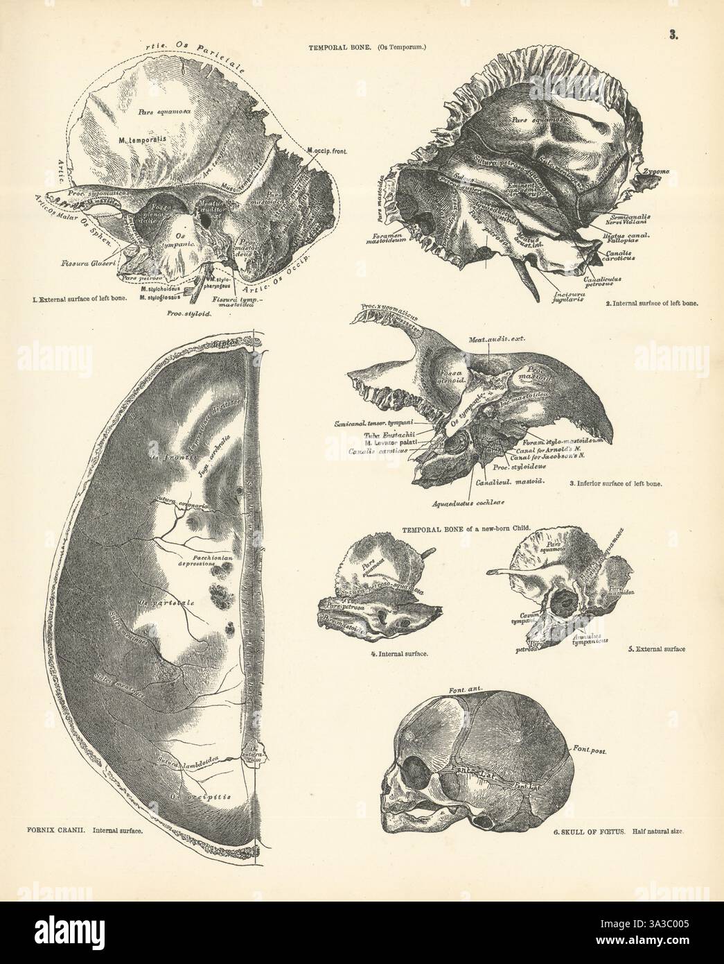 Anatomie. Os temporal adulte et nouveau-né. Crâne fœtal. Fornix cranii 1880 Banque D'Images