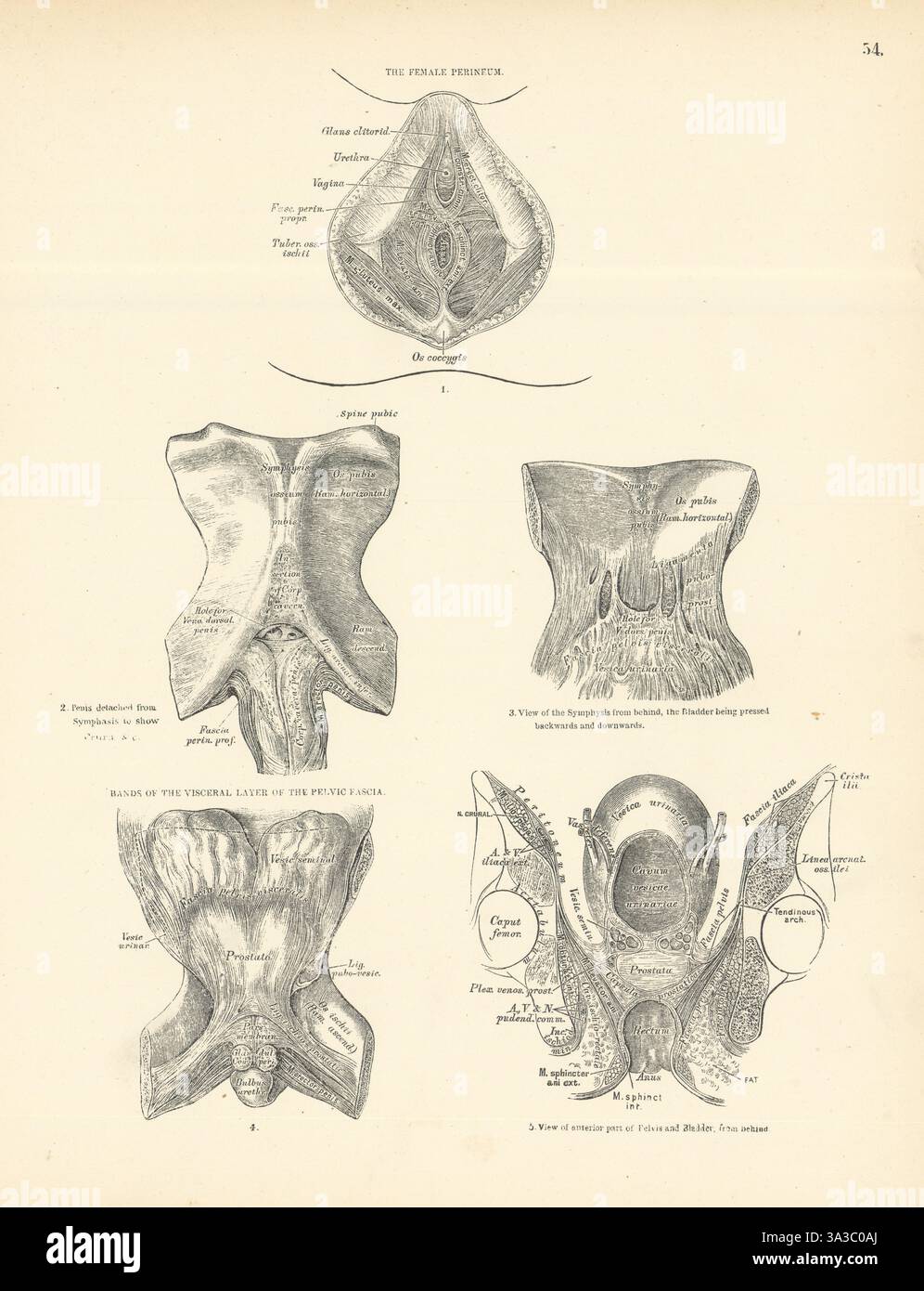 Anatomie. Périnée femelle, bandes de fascia pelvien 1880 vieille image d'impression antique Banque D'Images