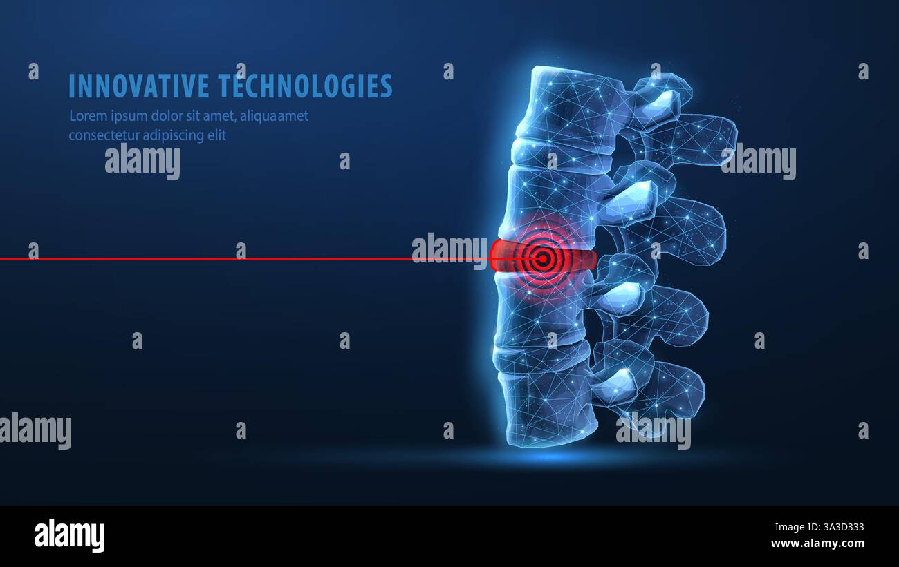 vecteur de colonne vertébrale 3d sur fond bleu. Soins chiropratiques, moelle épinière, chirurgie orthopédique. Illustration de Vecteur