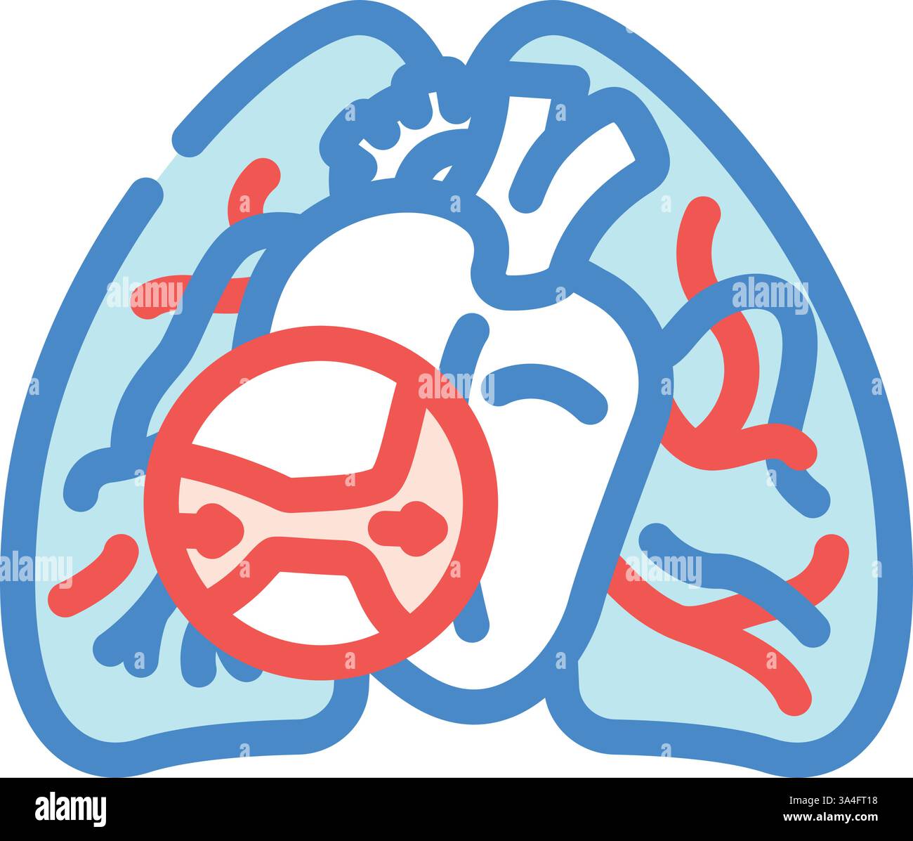 illustration vectorielle d'icône de couleur de maladie cardiologique d'hypertension pulmonaire Illustration de Vecteur