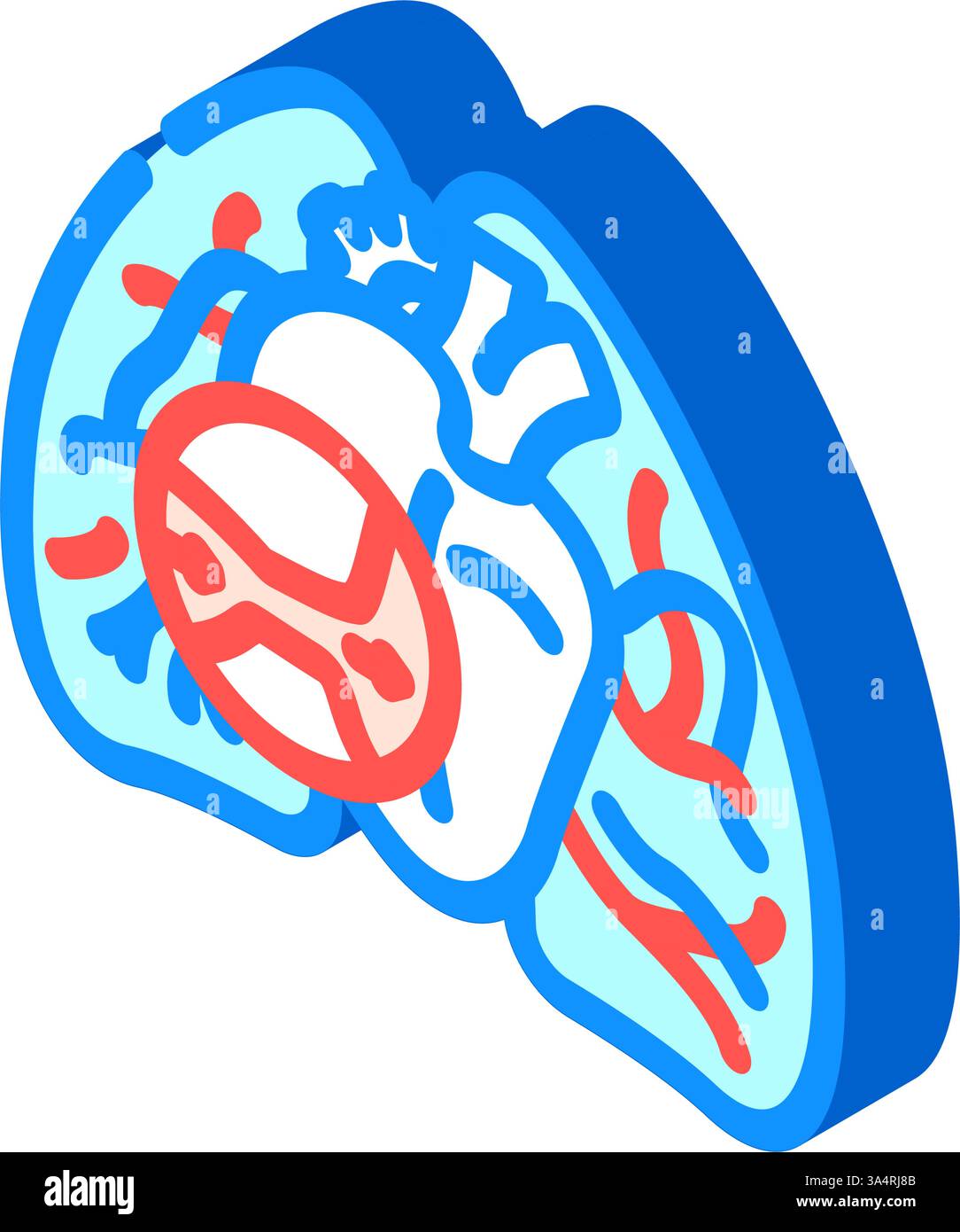 illustration vectorielle isométrique de l'icône de la cardiologie de l'hypertension pulmonaire Illustration de Vecteur